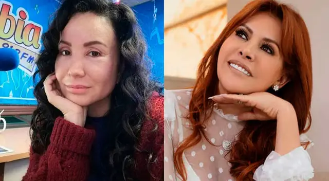 La periodista Magaly Medina admitió que se hizo unas 'retoques' en el rostro para verse mejor.