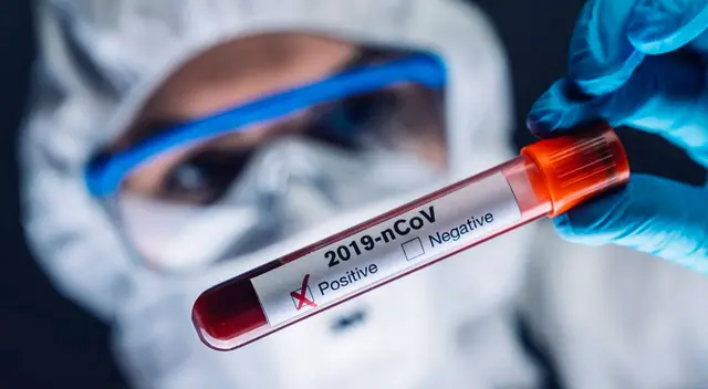 Hombre que tenía coronavirus se quitó la vida en Ucayali. Hombre que tenía coronavirus se quitó la vida en Ucayali.