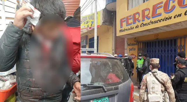 Un miembro de la PNP terminó con la cabeza rota. Un miembro de la PNP terminó con la cabeza rota.