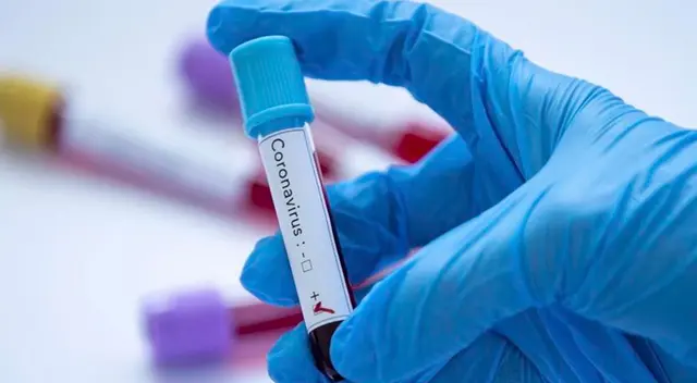 La vacuna contra el Covid-19 no ha sido aprobada por más expertos. La vacuna contra el Covid-19 no ha sido aprobada por más expertos.