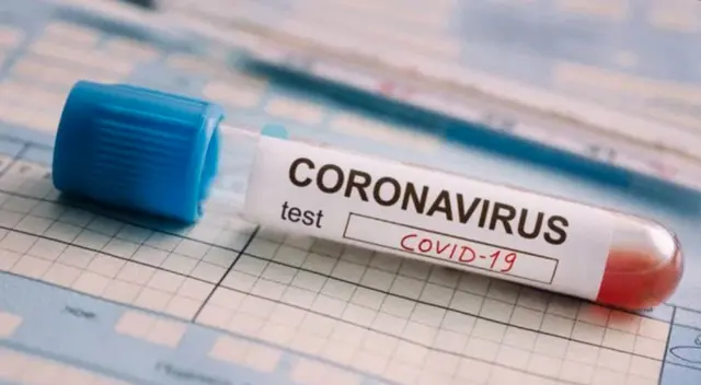 San Miguel: Vecinos alertaron que pruebas rápidas usadas fueron desechadas en plena calle