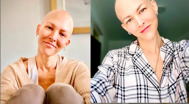 Anahí de Cárdenas se despide de las quimioterapias.