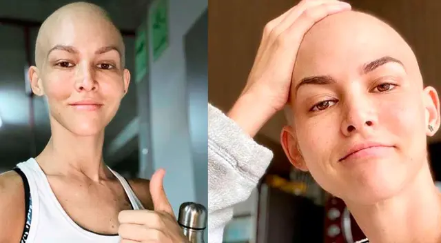 A pesar de que Anahí de Cárdenas terminó la primera parte de su tratamiento contra el cáncer de mama, ella confesó que aún está agotada físicamente.