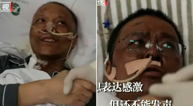 Murió el médico que cambió de color de piel luego de infectarse con el coronavirus. Murió el médico que cambió de color de piel luego de infectarse con el coronavirus.