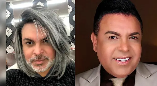 Chibolín se dejó crecer el cabello en cuarentena. Chibolín se dejó crecer el cabello en cuarentena.