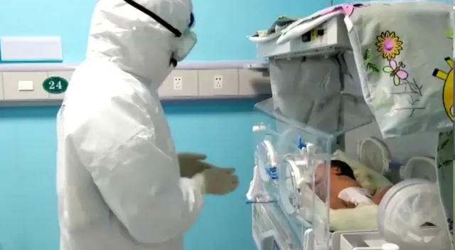 El bebé tuvo dificultades para respirar a las 48 horas de nacido.