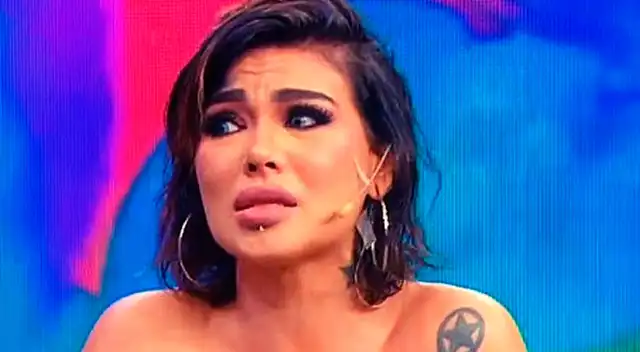 Angie Jibaja muestra las cicatrices.