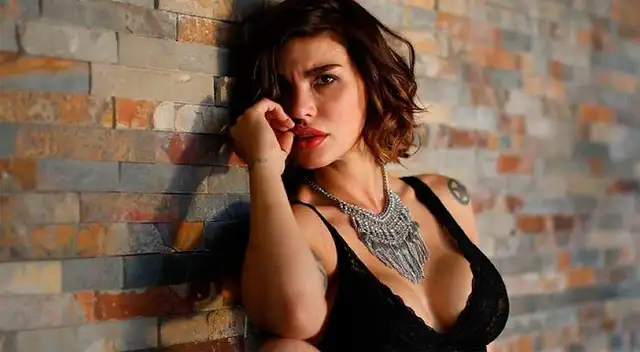 Angie Jibaja muestra las cicatrices.