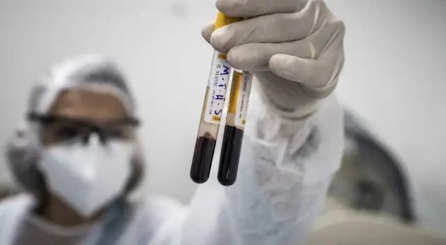 Solo habrá inmunidad natural cuando el 70 % de peruanos haya contraído el coronavirus.