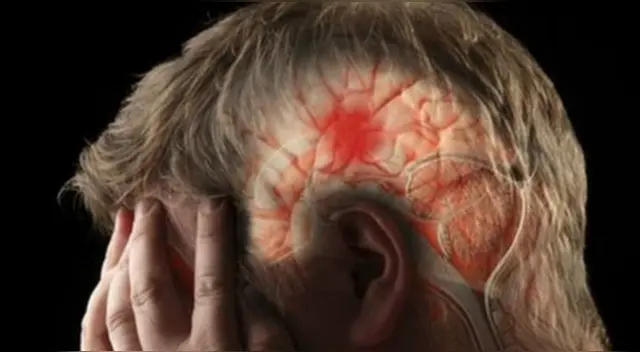 El artículo científico de la Academia de Oxford ha sido publicado por la revista Neurosurgery.