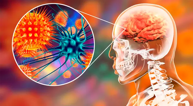 El Nipah es una nueva enfermedad zoonótica.