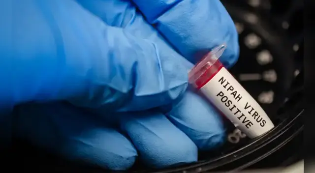 ¿Existe la vacuna para el virus del Nipha?