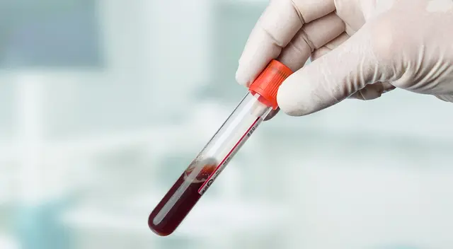 Los científicos afirmaron que la presencia de las variantes genéticas predispone al desarrollo de formas graves de síntomas de coronavirus.