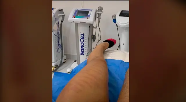 Mujer se somete a depilación láser y termina con la piel quemada. Mujer se somete a depilación láser y termina con la piel quemada.