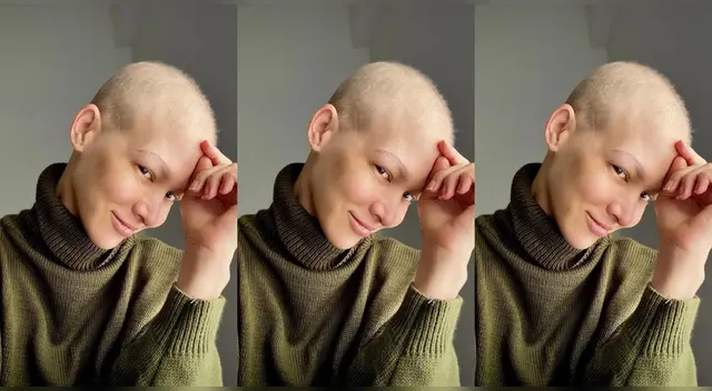 La actriz Anahí de Cárdenas compartió emocionada como el cabello le creció, y confesó haberse sentido asustada de que este no le volviera a aparecer. La actriz Anahí de Cárdenas compartió emocionada como el cabello le creció, y confesó haberse sentido asustada de que este no le volviera a aparecer.