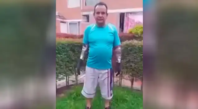 Hombre crea su propio brazo ortopédico y sorprende a todos en TikTok