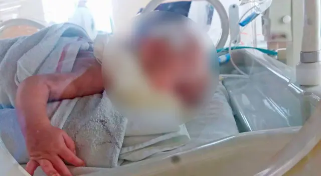 La madre de 27 años señala que aún debe esperar 3 o 4 meses para el tratamiento del bebé. La madre de 27 años señala que aún debe esperar 3 o 4 meses para el tratamiento del bebé.