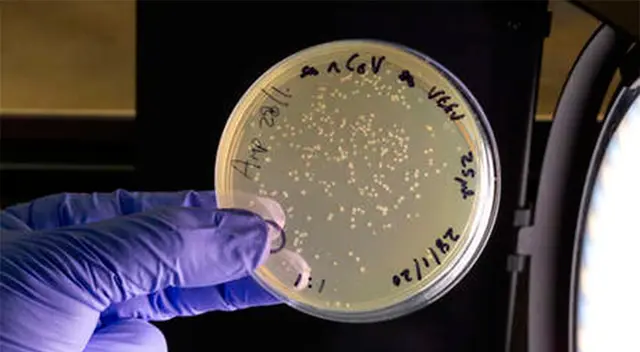 El filtro de aire es capaz de matar a casi el 99% del virus.