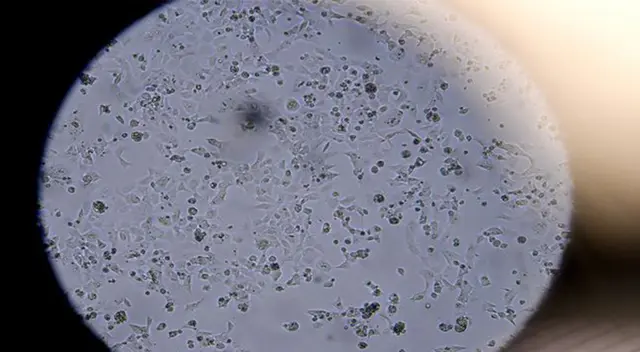 El filtro de aire es capaz de matar a casi el 99% del virus.