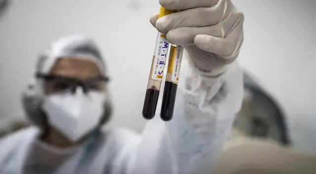 Minsa actualizó cifra de infectados por coronavirus. Minsa actualizó cifra de infectados por coronavirus.