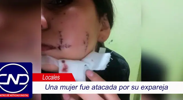 Dictan prisión contra Guillermo Alvarez López por atacar con el pico de una botella a su ex pareja Dictan prisión contra Guillermo Alvarez López por atacar con el pico de una botella a su ex pareja