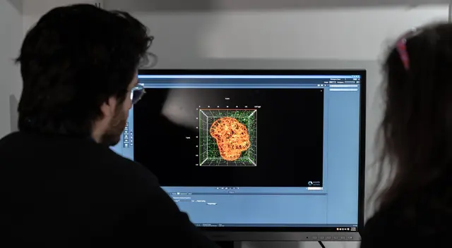 El coronavirus causa que los pulmones acumulen grasa, según el estudio. El coronavirus causa que los pulmones acumulen grasa, según el estudio.