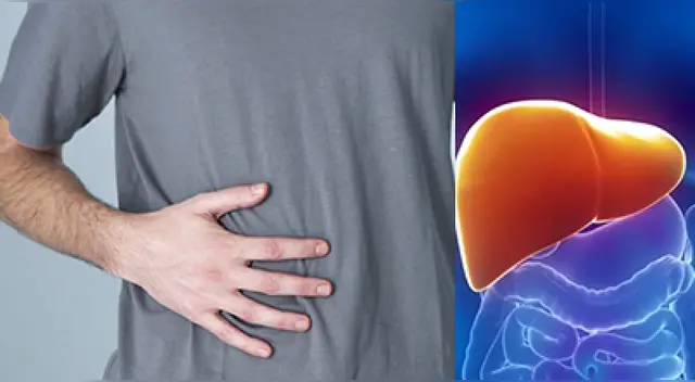 El hombre fue diagnosticado con clonorquiasis, conocido como “duela hepática china”.