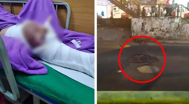 La familia de Enzo se encuentra desesperada y pide ayuda urgente, ya que el SOAT está copado y no saben qué más hacer para salvarle la pierna.