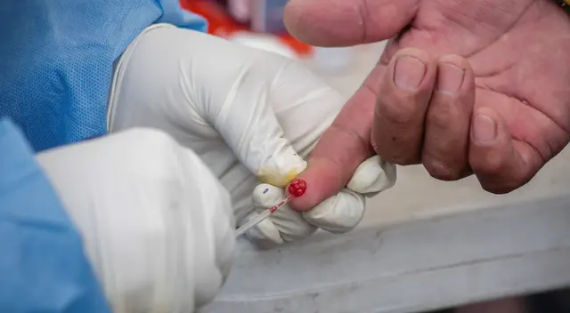 Detienen a funcionario de EsSalud que vendía pruebas rápidas. Foto referencial. Detienen a funcionario de EsSalud que vendía pruebas rápidas. Foto referencial.