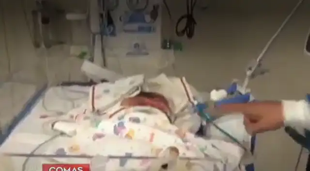 Bebé de 7 meses venció al COVID-19 tras permanecer en la Unidad de Cuidados Intensivos.