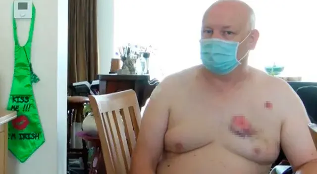 Hombre es mordido por otro luego de decirle que use mascarilla Hombre es mordido por otro luego de decirle que use mascarilla