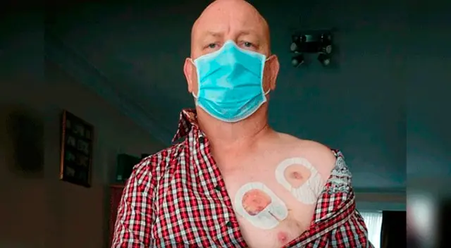 Hombre es mordido por otro luego de decirle que use mascarilla Hombre es mordido por otro luego de decirle que use mascarilla