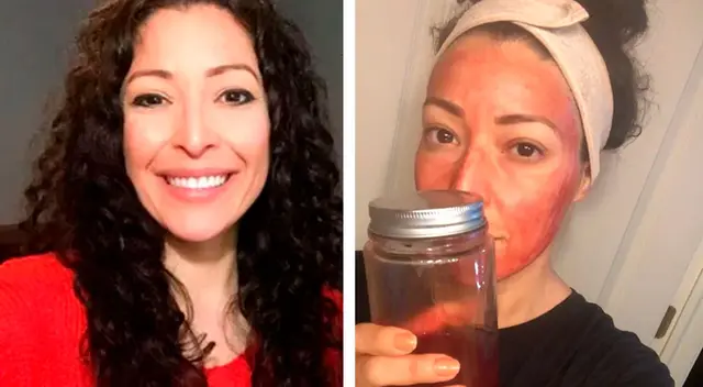 Mujer que utiliza su menstruación como mascarilla asegura que le deja la “piel brillante” Mujer que utiliza su menstruación como mascarilla asegura que le deja la “piel brillante”