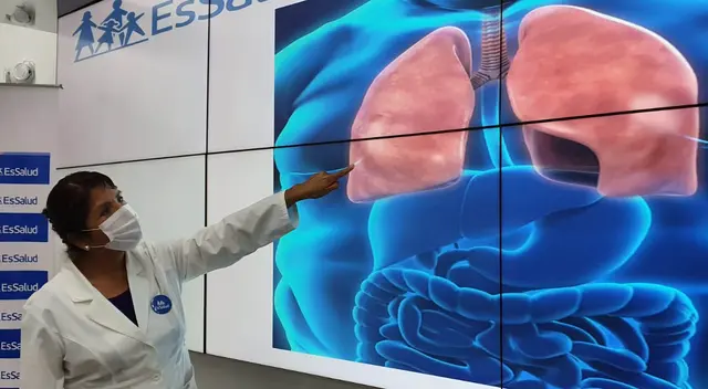 Desde EsSalud recomendaron llevar una vida saludable. (Foto: Deysi Portuguez/URPI-GLR).