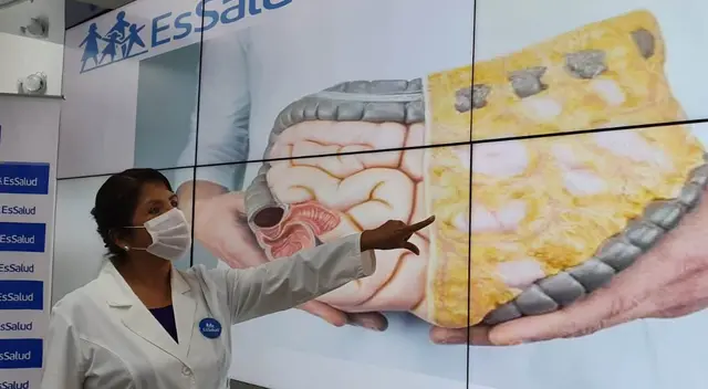 Desde EsSalud recomendaron llevar una vida saludable. (Foto: Deysi Portuguez/URPI-GLR).