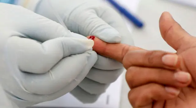 El Minsa hará entrega de 20.000 pruebas rápidas de forma progresiva para detectar los anticuerpos de la enfermedad.