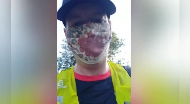 El especialista de salud indicó que decidió hacerlo, porque muchas personas aseguraban que sus niveles de oxígeno bajaban cuando lo usaban.