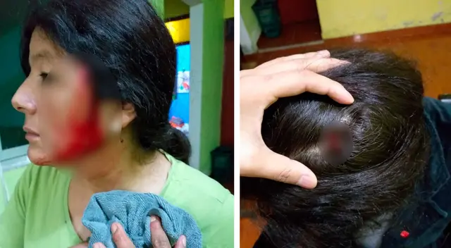 La ministra de la Mujer, Rosario Sasieta, se pronunció rápidamente para conocer más detalles sobre el hecho y brindar el apoyo correspondiente a fin de garantizar la vida de la obrera de limpieza. La ministra de la Mujer, Rosario Sasieta, se pronunció rápidamente para conocer más detalles sobre el hecho y brindar el apoyo correspondiente a fin de garantizar la vida de la obrera de limpieza.