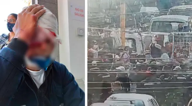 Fiscalizadores resultaron gravemente heridos y son atendidos en el Hospital Dos de Mayo.