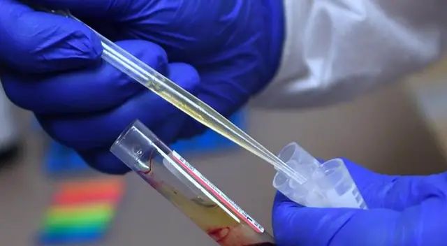 En septiembre se iniciaría con las vacunas de prueba para el coronavirus. En septiembre se iniciaría con las vacunas de prueba para el coronavirus.