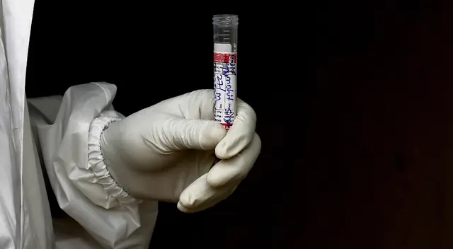 Minsa actualizó cifra de infectados por coronavirus.