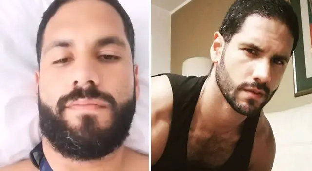 Sean Rico se facturó el brazo. Sean Rico se facturó el brazo.