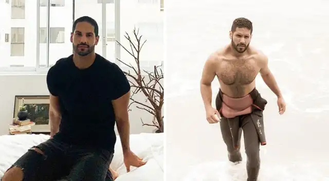 Sean Rico se facturó el brazo. Sean Rico se facturó el brazo.