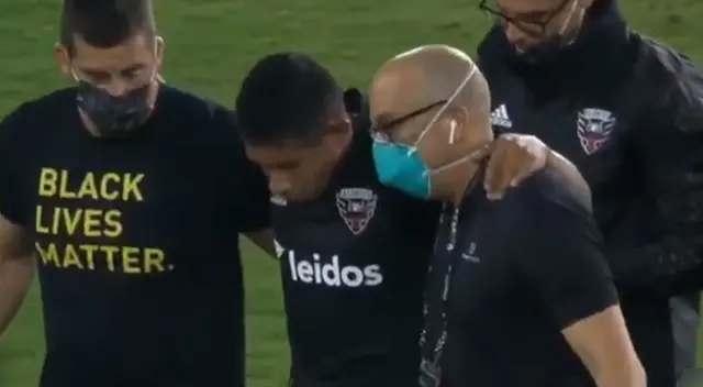 Edison Flores tuvo un duro choque con el defensa neerlandés Alexander Büttner. Edison Flores tuvo un duro choque con el defensa neerlandés Alexander Büttner.