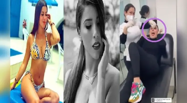 Yahaira Plasencia se habría realizado una rinomodelación con ácido hialurónico.