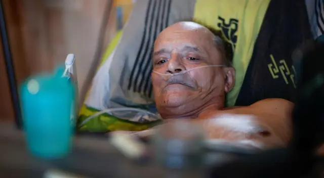 Alain Cocq, de 57 años, padece una enfermedad rara que hace que las paredes de sus arterias se peguen. Alain Cocq, de 57 años, padece una enfermedad rara que hace que las paredes de sus arterias se peguen.