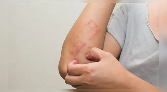 Las leucemias también se clasifican en función del tipo de célula sanguínea afectada.