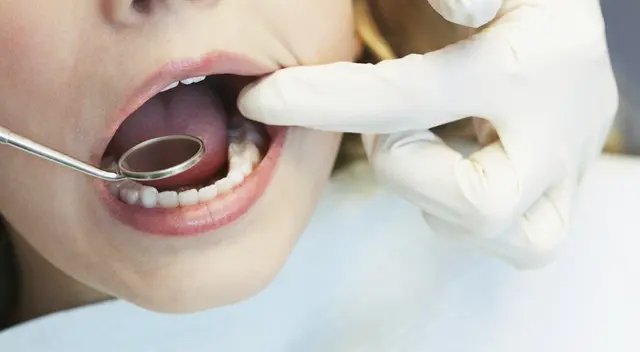 Los altos niveles de estrés por la pandemia COVID-19 han generado problemas bucales.