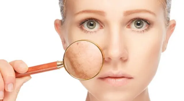 Belleza: aprende cómo quitar manchas del rostro de forma natural. Belleza: aprende cómo quitar manchas del rostro de forma natural.