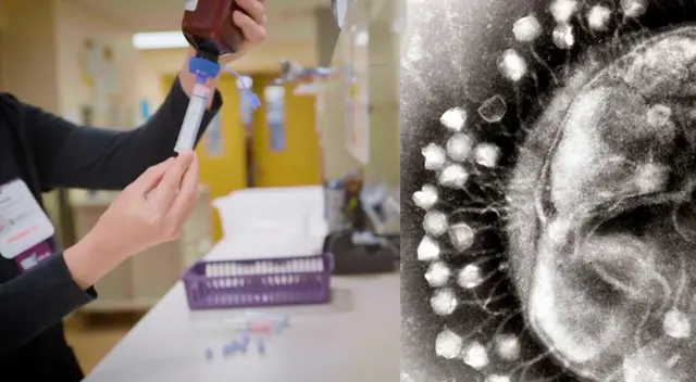 Imágenes del estudio de la Universidad de Pittsburgh. Imágenes del estudio de la Universidad de Pittsburgh.